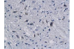 Formalin-fixed and paraffin embedded mouse brain labeled with Anti-DCX Polyclonal Antibody, Unconjugated (ABIN674184) followed by conjugation to the secondary antibody and DAB staining (Doublecortin 抗体)