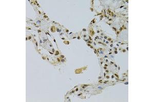 Immunohistochemistry of paraffin-embedded human lung using NLK antibody (ABIN5971636) at dilution of 1/100 (40x lens). (Nemo-Like Kinase 抗体)