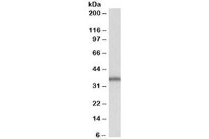 Western blot testing of Daudi lysate with SLC9A3R2 antibody at 1ug/ml. (SLC9A3R2 (Isoforms b & E) 抗体)
