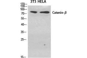 Western Blot (WB) analysis of specific cells using Catenin-beta Polyclonal Antibody. (beta Catenin 抗体  (Ser29))