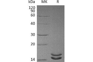 Greater than 95 % as determined by reducing SDS-PAGE. (IL-2 Protein (His tag))