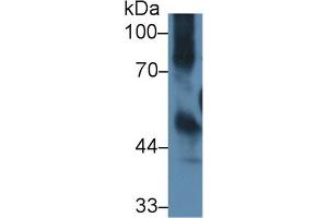 Detection of ICAM1 in Mouse Thymus lysate using Polyclonal Antibody to Intercellular Adhesion Molecule 1 (ICAM1) (ICAM1 抗体  (AA 328-465))