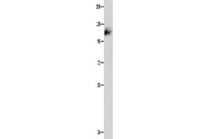 Western Blotting (WB) image for anti-Amphiphysin (AMPH) antibody (ABIN2427737) (Amphiphysin 抗体)