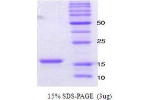 Figure annotation denotes ug of protein loaded and % gel used. (alpha Synuclein A30P A53T (active) 蛋白)