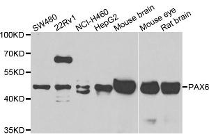 Western blot analysis of extracts of various cell lines, using PAX6 antibody (ABIN5975500) at 1/1000 dilution. (PAX6 抗体)