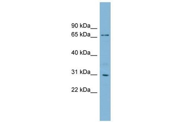 TBCCD1 抗体  (N-Term)