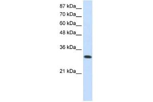 SCYE1 antibody used at 0. (AIMP1 抗体)