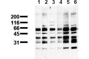 Western Blotting (WB) image for anti-Phosphoserine (phosphorylated) antibody (ABIN126863) (Phosphoserine 抗体  (phosphorylated))