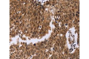 Immunohistochemistry (IHC) image for anti-Excision Repair Cross-Complementing Rodent Repair Deficiency, Complementation Group 6-Like (ERCC6L) antibody (ABIN2423388) (ERCC6L 抗体)