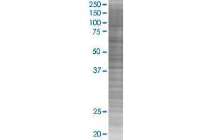 Western Blotting (WB) image for GYG2 293T Cell Transient Overexpression Lysate(Denatured) (ABIN1334325)