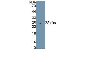 Detection of Recombinant HSPA5, Rat using Polyclonal Antibody to Heat Shock 70 kDa Protein 5 (HSPA5) (GRP78 抗体  (AA 260-469))