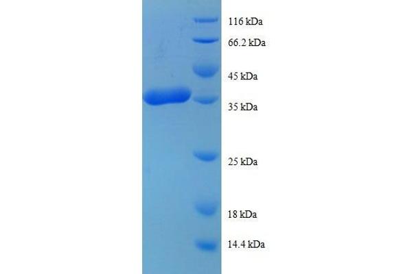 RPL38 Protein (AA 2-70) (GST tag)