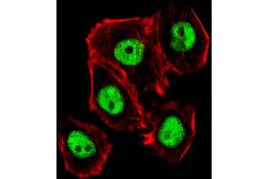 Fluorescent image of A431 cells stained with Mouse Ctr9 Antibody (C-term) (ABIN6243851 and ABIN6577807). (CTR9 抗体  (C-Term))
