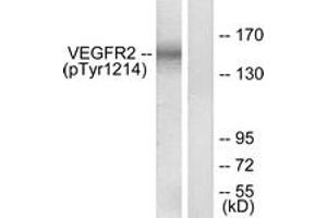 Western Blotting (WB) image for anti-VEGF Receptor 2 (VEGFR2) (pTyr1214) antibody (ABIN2888556) (VEGFR2/CD309 抗体  (pTyr1214))
