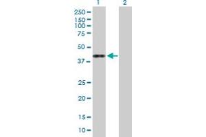 Western Blot analysis of ASRGL1 expression in transfected 293T cell line by ASRGL1 MaxPab polyclonal antibody. (ASRGL1 抗体  (AA 1-308))