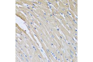 Immunohistochemistry of paraffin-embedded rat heart using CRHBP antibody. (CRHBP 抗体)