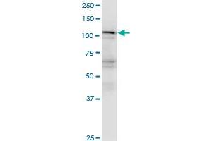 Western Blotting (WB) image for anti-Importin 5 (IPO5) (AA 1-100) antibody (ABIN561620)