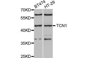 Western blot analysis of extracts of various cell lines, using TCN1 antibody (ABIN5973815) at 1/1000 dilution. (TCN1 抗体)