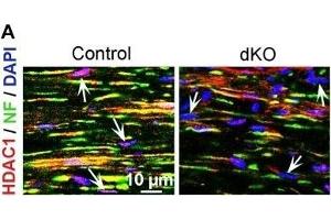 Immunofluorescence (Paraffin-embedded Sections) (IF (p)) image for anti-Histone Deacetylase 1 (HDAC1) antibody (ABIN2854776)