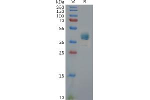 Human C Protein, hFc Tag on SDS-PAGE under reducing condition. (CXCR3 Protein (AA 1-53) (Fc Tag))