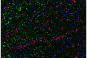 Image no. 2 for anti-Interferon gamma (IFNG) antibody (ABIN465463) (Interferon gamma 抗体)