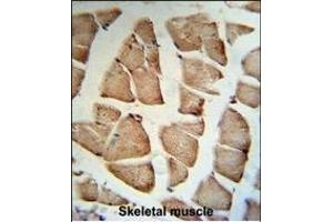 GSN Antibody (C-term) (R) IHC analysis in formalin fixed and paraffin embedded human Skeletal muscle tissue followed by peroxidase conjugation of the secondary antibody and DAB staining. (Gelsolin 抗体  (C-Term))