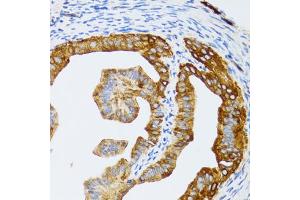 Immunohistochemistry of paraffin-embedded rat fallopian tube using CHAF1B antibody (ABIN5973690) at dilution of 1/100 (40x lens). (CHAF1B 抗体)