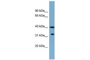 KCTD9 antibody used at 1 ug/ml to detect target protein. (KCTD9 抗体  (Middle Region))