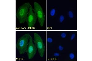 Immunofluorescence (IF) image for anti-Tripartite Motif Containing 28 (TRIM28) (C-Term) antibody (ABIN184913)