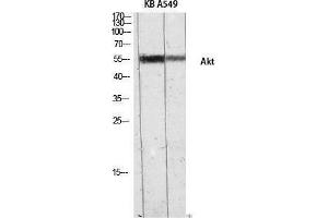 Western Blotting (WB) image for anti-V-Akt Murine Thymoma Viral Oncogene Homolog 1 (AKT1) (Internal Region) antibody (ABIN6283882) (AKT1 抗体  (Internal Region))