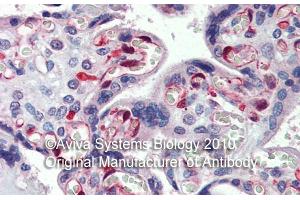 Rabbit Anti-NOL5A Antibody ,Paraffin Embedded Tissue: Human Placenta  Antibody Concentration: 5 µg/mL (NOP56 抗体  (Middle Region))
