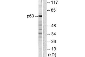 Western Blotting (WB) image for anti-T-Complex 1 (TCP1) (C-Term) antibody (ABIN1848723) (TCP1 alpha/CCTA 抗体  (C-Term))