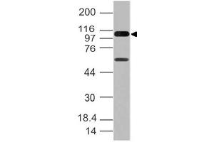 Image no. 1 for anti-DEAD (Asp-Glu-Ala-Asp) Box Polypeptide 58 (DDX58) (AA 1-220) antibody (ABIN5027276) (DDX58 抗体  (AA 1-220))