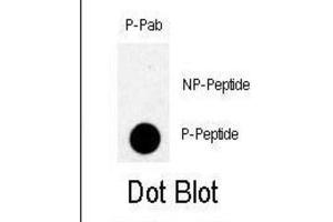 Dot Blot (DB) image for anti-TBK (pSer172) antibody (ABIN3001894) (TBK (pSer172) 抗体)