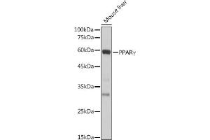 Western blot analysis of extracts of Mouse liver, using PPARγ antibody (ABIN6134090, ABIN6146004, ABIN6146006 and ABIN6215096) at 1:1000 dilution. (PPARG 抗体  (AA 70-170))