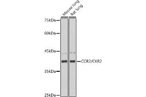 Western blot analysis of extracts of various cell lines, using CCR2/CKR2 antibody (ABIN7266304) at 1:1000 dilution. (CCR2 抗体)