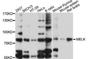 Western blot analysis of extracts of various cell lines, using MELK antibody. (MELK 抗体)