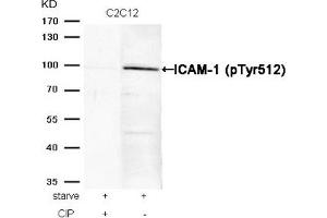 Western blot analysis of extracts from C2C12 cells, treated with starve or calf intestinal phosphatase (CIP), using ICAM-1 (Phospho-Tyr512) Antibody. (ICAM1 抗体  (pTyr512))