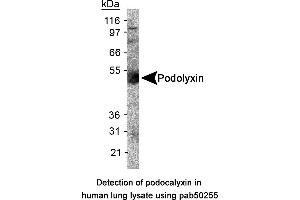 Image no. 1 for anti-Podocalyxin-Like (PODXL) (AA 100-200), (Internal Region) antibody (ABIN363564) (PODXL 抗体  (Internal Region))