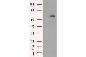 Western Blotting (WB) image for anti-Bruton Agammaglobulinemia tyrosine Kinase (BTK) antibody (ABIN1496977) (BTK 抗体)