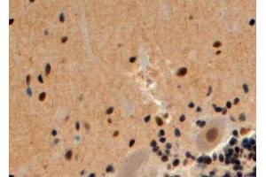 Immunohistochemistry (IHC) image for anti-Arrestin, beta 2 (ARRB2) (Internal Region) antibody (ABIN185395)