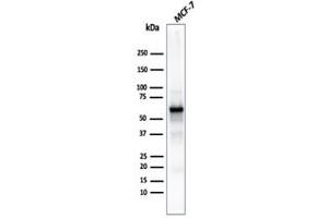 Immunohistochemistry (IHC) image for anti-V-Akt Murine Thymoma Viral Oncogene Homolog 1 (AKT1) (AA 85-189) antibody (ABIN6939338)