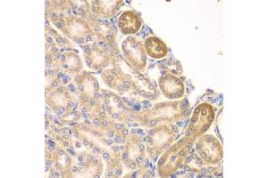 Immunohistochemistry of paraffin-embedded rat kidney using PIP4K2A antibody (ABIN6130624, ABIN6145673, ABIN6145674 and ABIN6223324) at dilution of 1:100 (40x lens). (PIP4K2A 抗体  (AA 120-350))