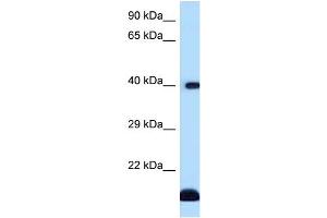 WB Suggested Anti-CD1D Antibody Titration: 1. (CD1d 抗体  (C-Term))