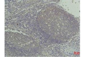 Immunohistochemistry (IHC) analysis of paraffin-embedded Human Tonsil Tissue using TNF a Mouse Monoclonal Antibody diluted at 1:50. (TNF alpha 抗体)