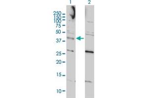 Western Blot analysis of CCNK expression in transfected 293T cell line by CCNK monoclonal antibody (M01), clone 3B7-1B9. (Cyclin K 抗体  (AA 1-354))