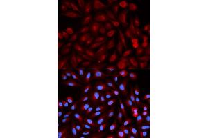 Immunofluorescence analysis of HeLa cells using PSME3 antibody (ABIN5970101). (PSME3 抗体)