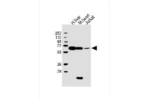 All lanes : Anti-PGM1 Antibody (C-Term) at 1:2000 dilution Lane 1: human liver lysate Lane 2: mouse heart lysate Lane 3: Jurkat whole cell lysate Lysates/proteins at 20 μg per lane. (Phosphoglucomutase 1 抗体  (AA 469-501))