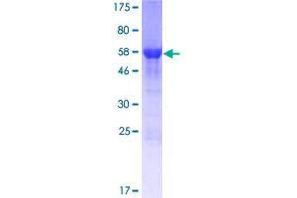 CCDC69 Protein (AA 1-296) (GST tag)