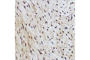 Immunohistochemistry of paraffin-embedded mouse heart using R Rabbit mAb (ABIN7269844) at dilution of 1:100 (40x lens). (RanBP3 抗体)